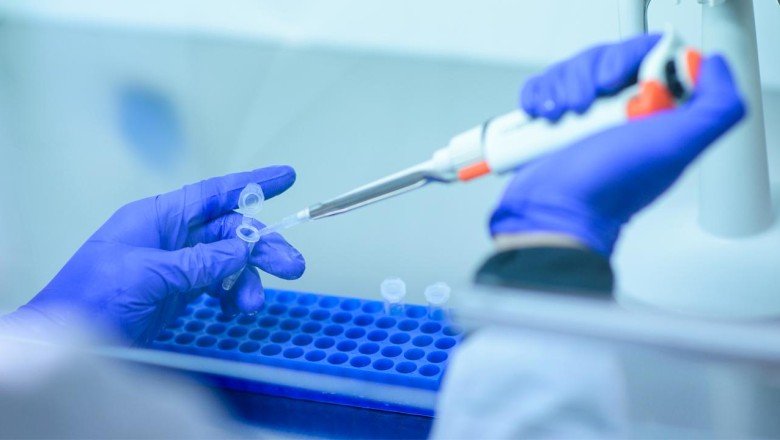 Yerli kuduz aşısının yeniden üretimi için harekete geçildi