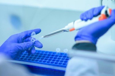 Yerli kuduz aşısının yeniden üretimi için harekete geçildi