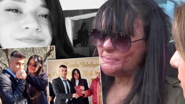 Türkiye günlerce Berfin Özek'i konuşmuştu! Yüzüne asit atan erkek arkadaşıyla evlendi