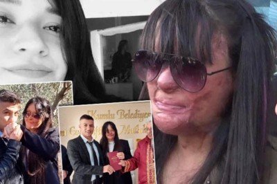 Türkiye günlerce Berfin Özek'i konuşmuştu! Yüzüne asit atan erkek arkadaşıyla evlendi