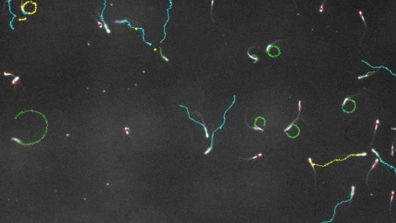 Erkekler için yeni bir doğum kontrol yöntemi geliştirildi