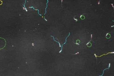 Erkekler için yeni bir doğum kontrol yöntemi geliştirildi