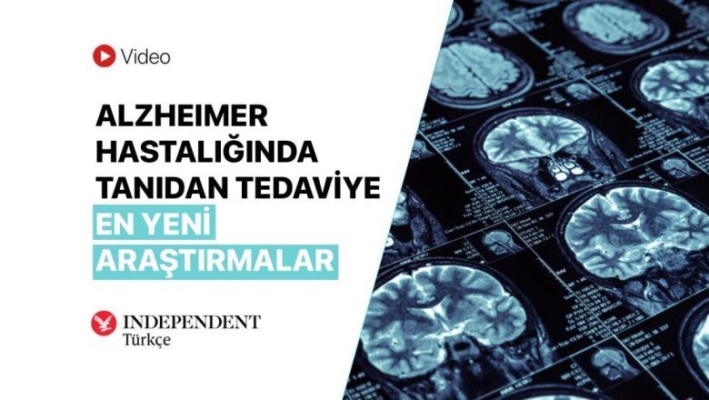 Alzheimer hastalığında tanıdan tedaviye en yeni araştırmalar: Alzheimer aşıları ve yeni tedavi seçenekleri neler?