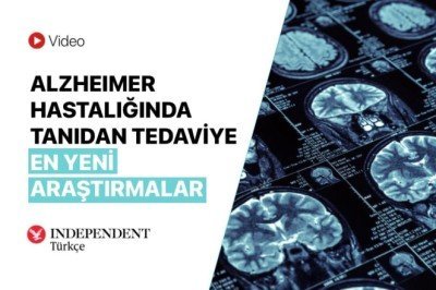 Alzheimer hastalığında tanıdan tedaviye en yeni araştırmalar: Alzheimer aşıları ve yeni tedavi seçenekleri neler?