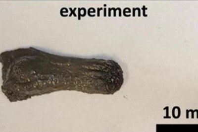 Görünüşü oldukça tuhaf! Yanlışlıkla yutulmuş nesneleri toplayabilir