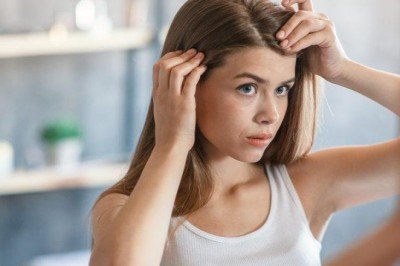 Kepekli saç görünümünden kurtulmak için