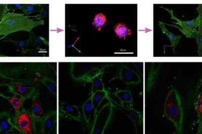 Devrim niteliğinde! Cilt hücrelerini 30 yıl gençleştirdiler