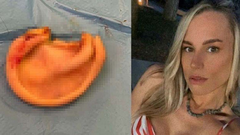 Etiler'de sahipli köpek saldırısı! Soruşturma sürüyor...