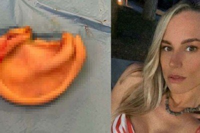 Etiler'de sahipli köpek saldırısı! Soruşturma sürüyor...