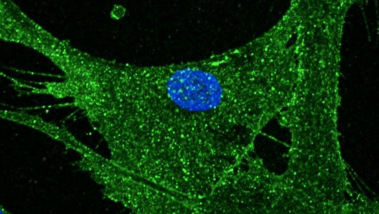 İngiltere'de deri hücresi 30 yıl gençleştirildi