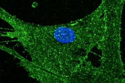 İngiltere'de deri hücresi 30 yıl gençleştirildi