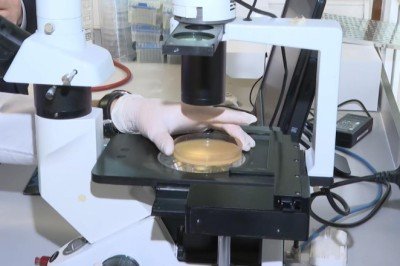 Kişinin kendi derisinden yapay deri üretmeyi başardılar