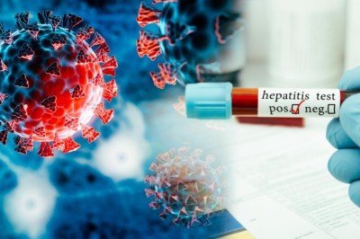 COVID19 olmasaydı Gizemli hepatit olur muydu?