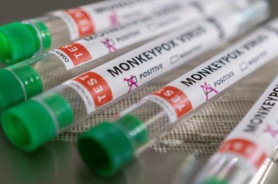 Maymun çiçeği ile ilgili bilinmesi gerekenler: Çiçek aşısı çare olabilir