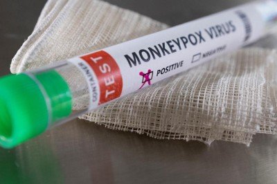 Maymun çiçeğine potansiyel antiviral tedavi