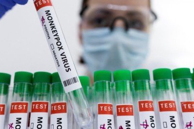 Prof. Dr. Kıvanç Şerefhanoğlu: Maymun çiçeği çocuklarda daha ciddi seyrediyor