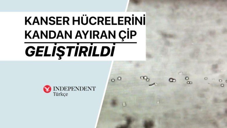 Kanser hücrelerini kandan ayıran çip geliştirildi