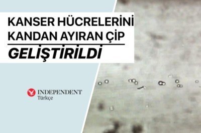 Kanser hücrelerini kandan ayıran çip geliştirildi