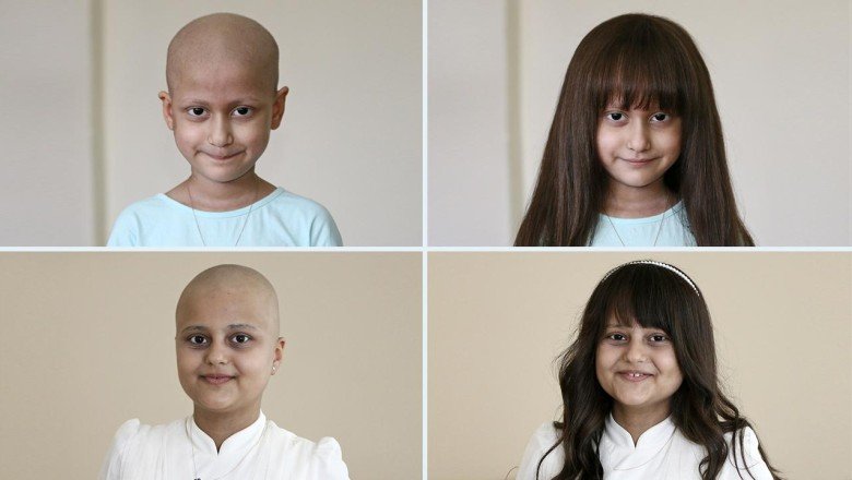 Ankaralı kuaför hasta çocuklara ücretsiz peruk hediye ediyor