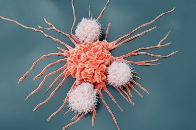 Bağışıklık sistemiyle gelen çare: Kanser tarihe mi karışıyor?