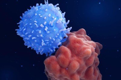 CART Hücre Tedavisi: Kanserin çaresi kendi hücrelerimiz olabilir mi?