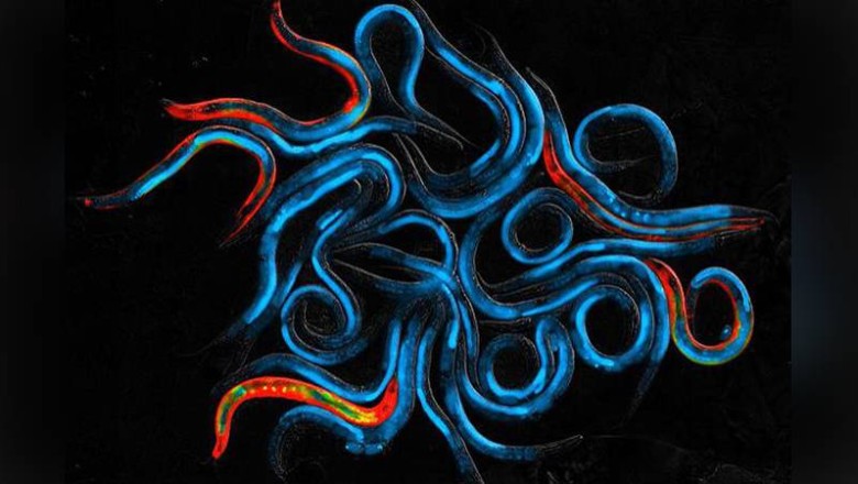 Bilim insanları iplik kurtlarının yaşamını uzatmanın yolunu buldu: "Daha sağlıklı yaşlanmamızın önünü açacak"