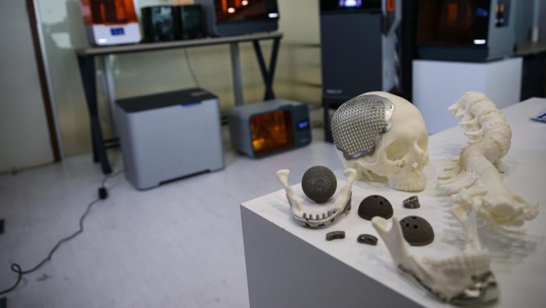 Yazıcıdan çıkan implantlar dünyaya açılıyor