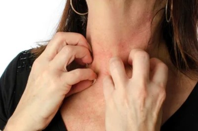 Alerjiye İyi Gelen Bitkiler Hangileridir?