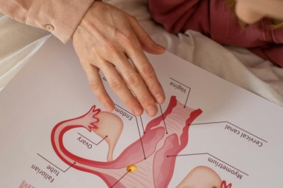 Endometriozis nedir? Belirtileri ve tedavi yöntemleri