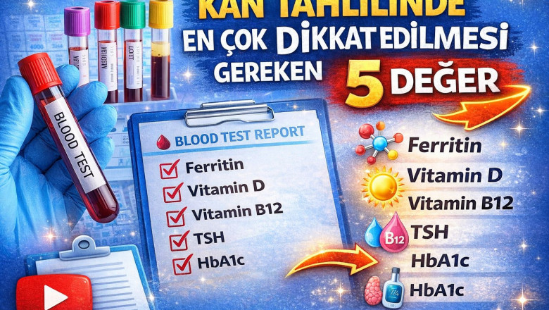 Kan Tahlilinde En Çok Dikkat Edilmesi Gereken 5 Değer